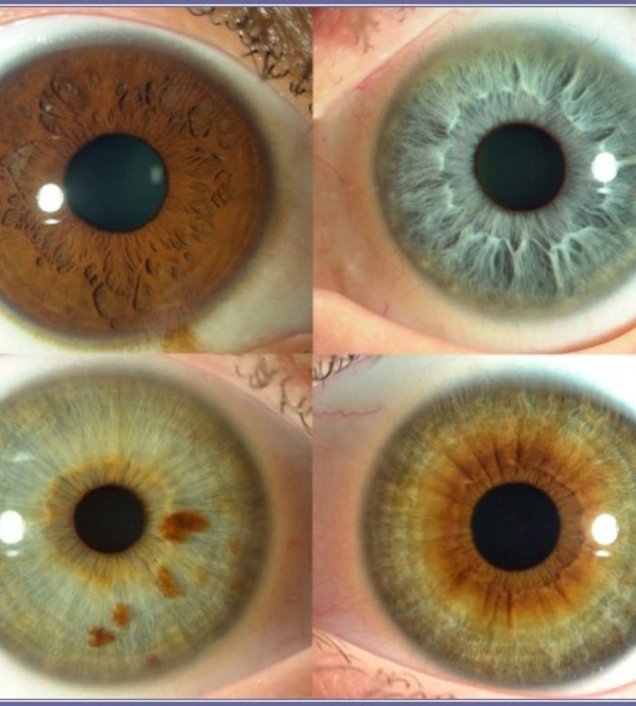 Iridology & Sclerology Consultation - Greensmith Grocers